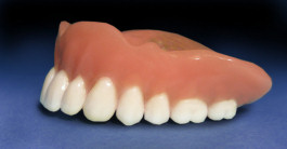 Implantatgetragener Zahnersatz