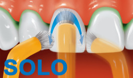 Anwendung der Solo-Bürste® am Zahnfleischrand